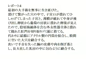 Page 3 of Kusoana Koumon Ningen Anus Kaizou Kiroku - preview thumbnail